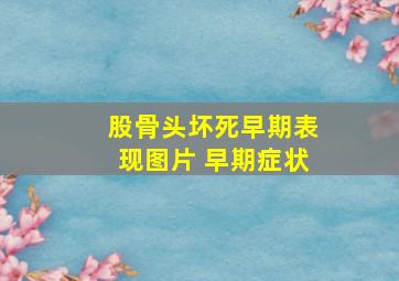 股骨头坏死早期表现图片 早期症状